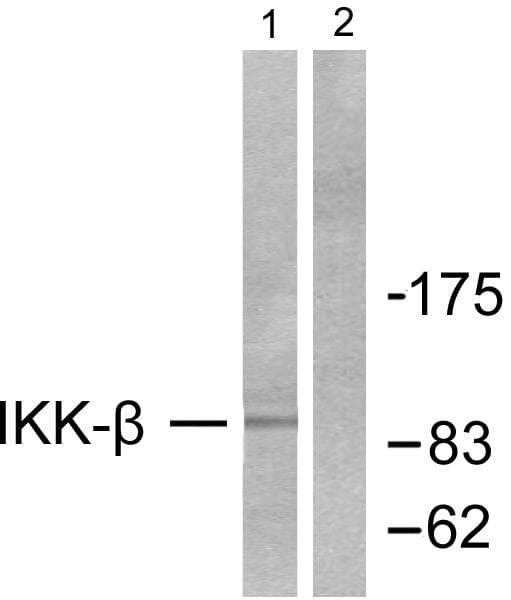 IKBKB / IKK2 / IKK Beta Antibody (p188)