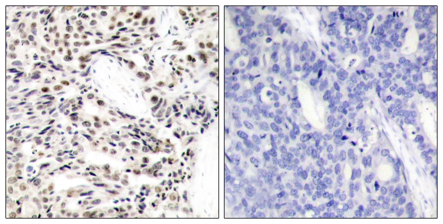 RELA / NFKB p65 Antibody (p529)