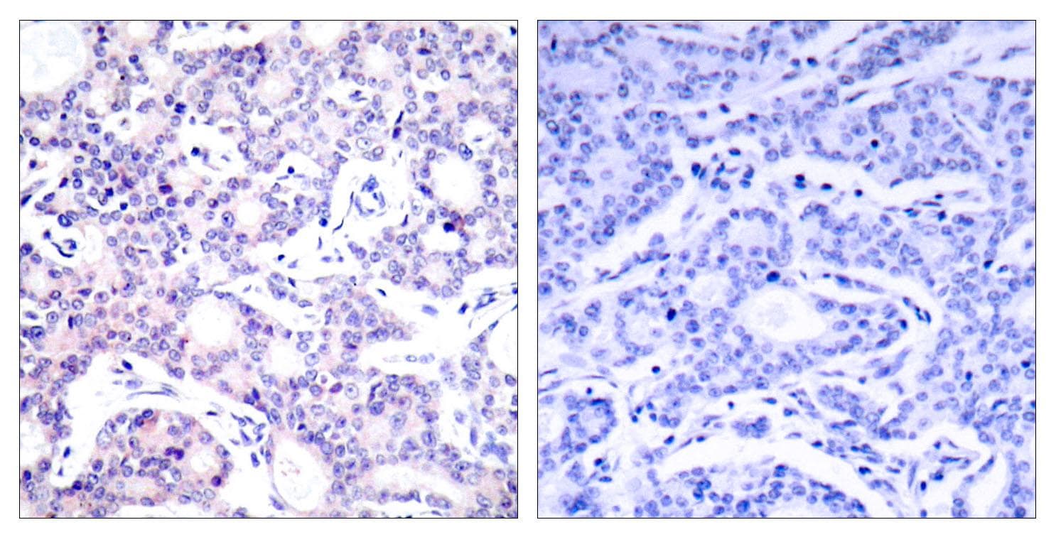 Polyclonal Rabbit anti-Human NFKB1 / NF-Kappa-B Antibody (p893, IHC, WB)