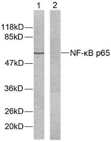 RELA / NFKB p65 Antibody (p536)