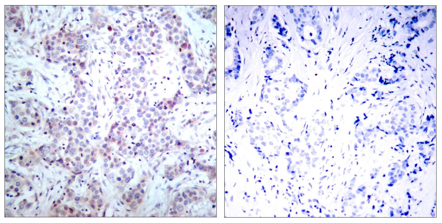 RELA / NFKB p65 Antibody (p536)