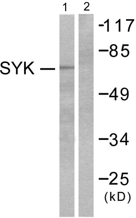 Polyclonal Rabbit anti-Human SYK Antibody (p348, IHC, WB)