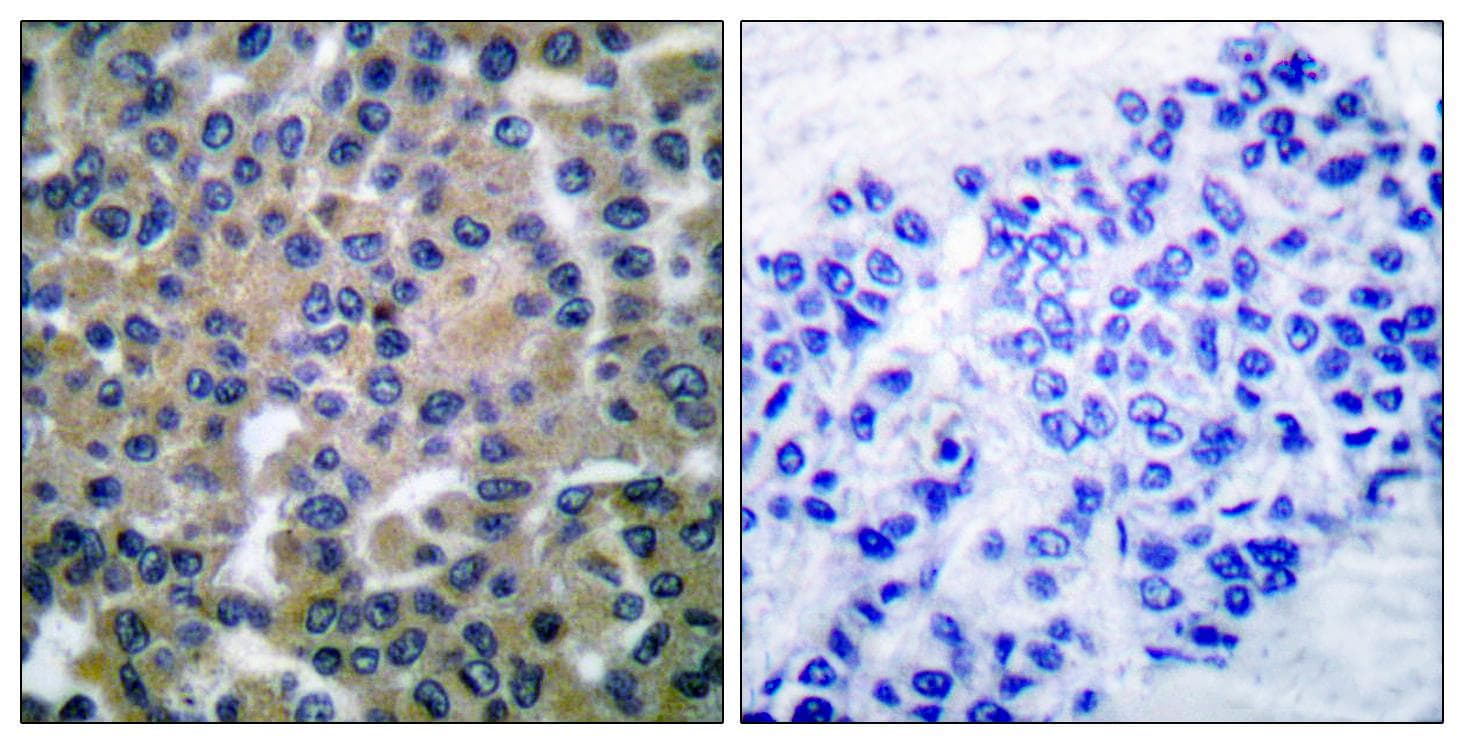 Polyclonal Rabbit anti-Human SYK Antibody (p348, IHC, WB)