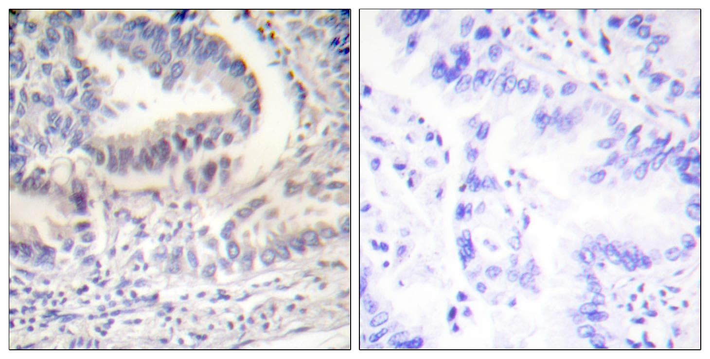 Polyclonal Rabbit anti-Human LMNA / Lamin A+C Antibody (Cleaved-Asp230, IHC, WB)
