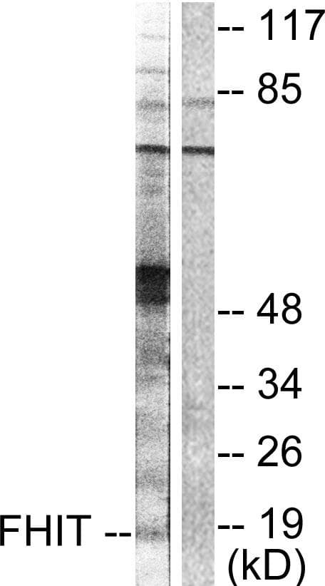 Polyclonal Rabbit anti-Human FHIT Antibody (IHC, IF, WB)
