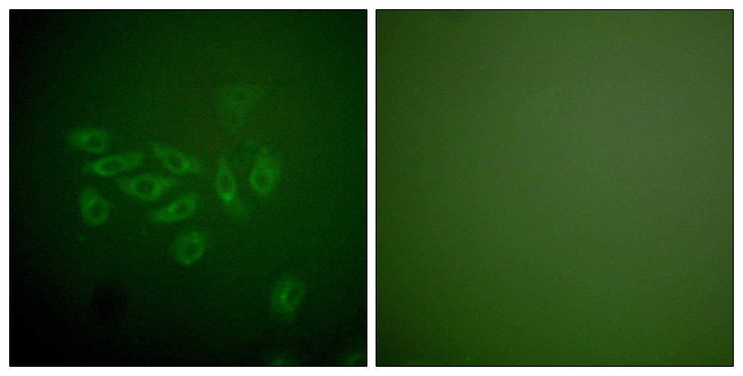 Polyclonal Rabbit anti-Human FHIT Antibody (IHC, IF, WB)
