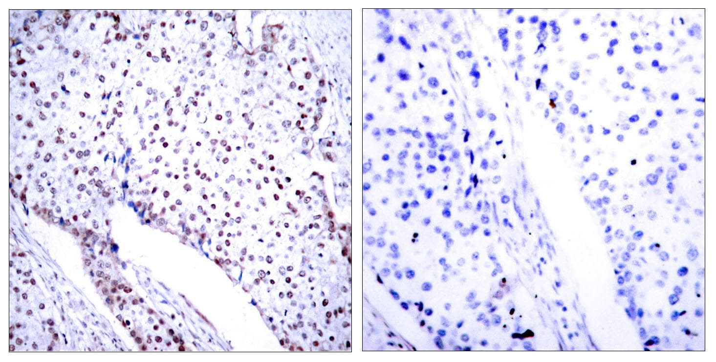 STAT3 Antibody (p705)