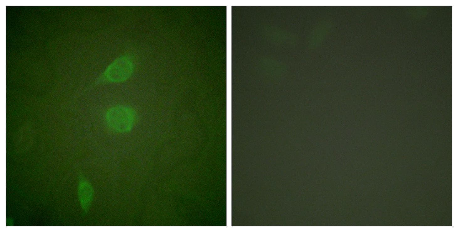 Polyclonal Rabbit anti-Human HDAC5 Antibody (IHC, IF, WB)