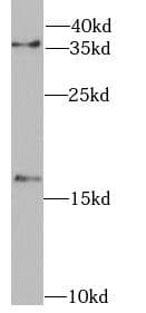 Polyclonal Rabbit anti-Human FHIT Antibody (IHC, WB)