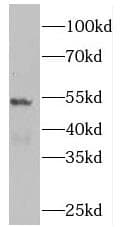 PLEKHO2 Antibody