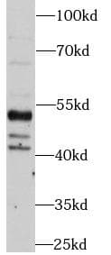 Polyclonal Rabbit anti-Human PTEN Antibody (IHC, WB)