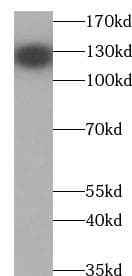Monoclonal Mouse anti-Human VCL / Vinculin Antibody (IHC, IF, WB)