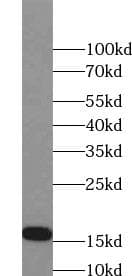 Polyclonal Rabbit anti-Human NPPA / ANP Antibody (IHC, WB)