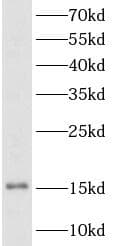 Polyclonal Rabbit anti-Human TSHB / TSH-Beta Antibody (IHC, IF, WB)