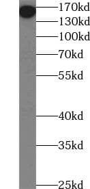 Mannose Receptor / CD206 Antibody (Intracellular Domain)