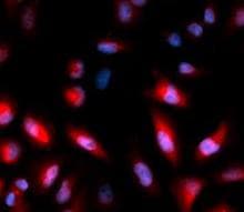 HSPB1 / HSP27 Antibody (phospho-Ser82)