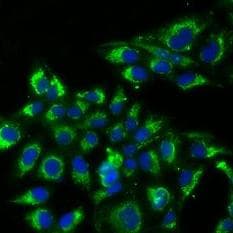 Polyclonal Rabbit anti-Human TSHB / TSH-Beta Antibody (IHC, IF, WB)