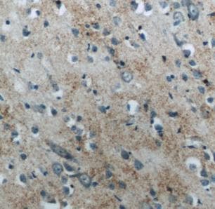 Polyclonal Rabbit anti-Human NPPB / BNP Antibody (IHC)