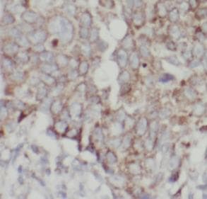 Monoclonal Mouse anti-Human EPCAM Antibody (IHC, WB)