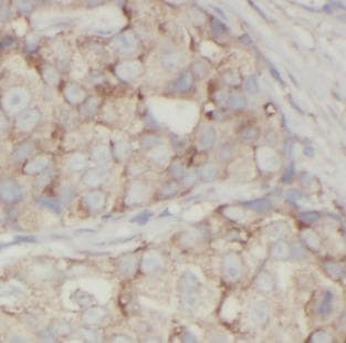 Monoclonal Mouse anti-Human VCL / Vinculin Antibody (IHC, IF, WB)