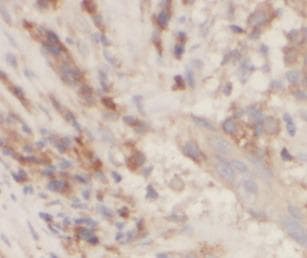 KDR / VEGFR2 / FLK1 Antibody