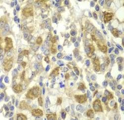 TNF Alpha Antibody
