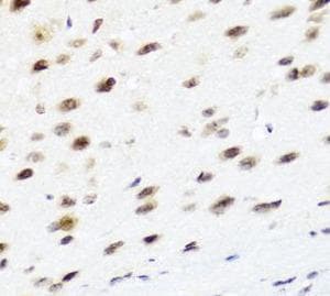 Polyclonal Rabbit anti-Human PTEN Antibody (IHC, WB)