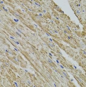 Polyclonal Rabbit anti-Human FHIT Antibody (IHC, WB)