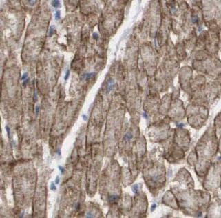 Polyclonal Rabbit anti-Human CXCR3 Antibody (IHC, WB)