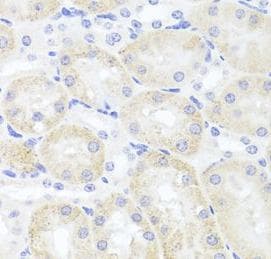 Polyclonal Rabbit anti-Human Adiponectin Antibody (IHC, WB)
