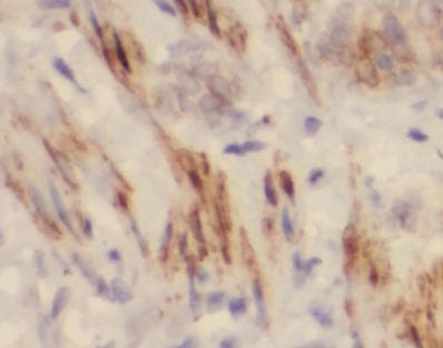 Polyclonal Rabbit anti-Human ELN / Elastin Antibody (IHC, WB)