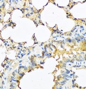 Polyclonal Rabbit anti-Human TSHB / TSH-Beta Antibody (IHC, IF, WB)