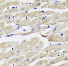 Polyclonal Rabbit anti-Human NPPA / ANP Antibody (IHC, WB)
