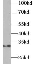 Polyclonal Rabbit anti-Human Adiponectin Antibody (IHC, WB)