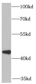 Polyclonal Rabbit anti-Human CXCR3 Antibody (IHC, WB)