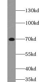 Polyclonal Rabbit anti-Human ELN / Elastin Antibody (IHC, WB)