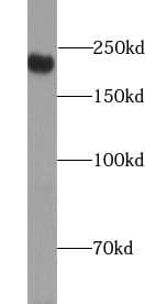 Monoclonal Mouse anti-Human CD45 / LCA Antibody (IHC, WB)