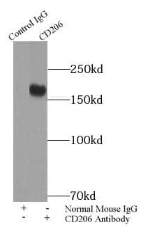 Mannose Receptor / CD206 Antibody (Intracellular Domain)