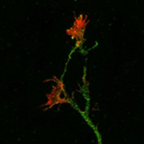 Polyclonal Chicken anti-Human APP / Beta Amyloid Precursor Antibody (aa433-452, IHC)