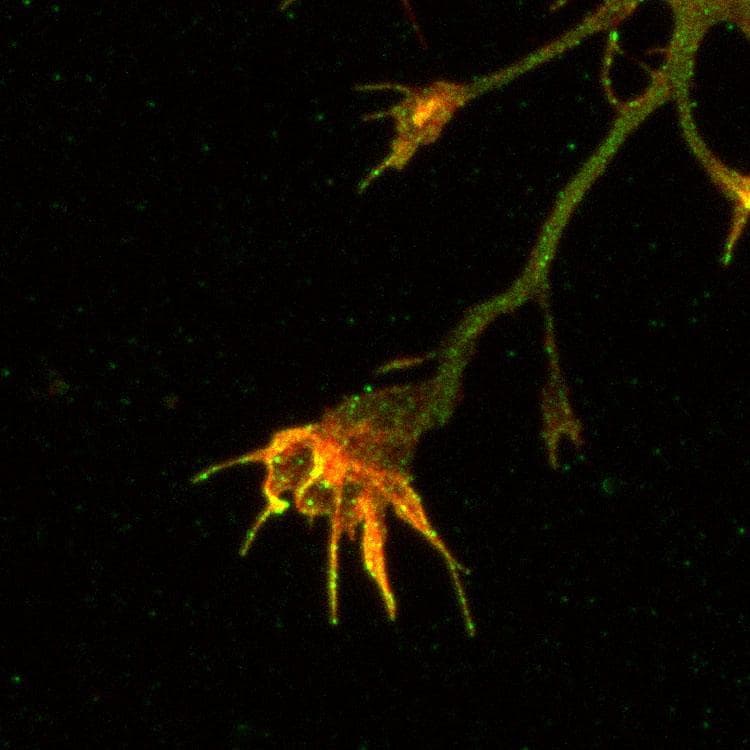 APP / Beta Amyloid Precursor Antibody (aa501-522)