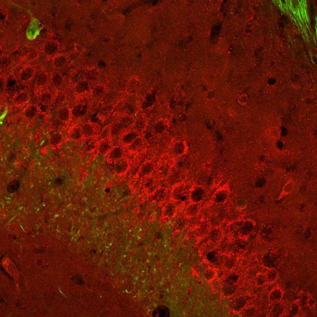 MGLUR2/3 / GLUR2/3 Antibody