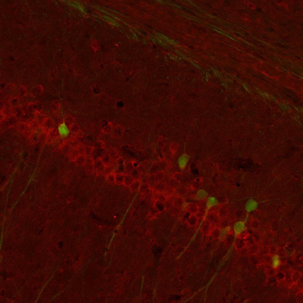 MGLUR2/3 / GLUR2/3 Antibody
