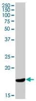 LL37 / Cathelicidin Antibody (clone H7)