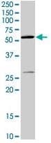 Monoclonal Mouse anti-Human CYBB / NOX2 / gp91phox Antibody (clone 54.1, IHC, IF, WB)