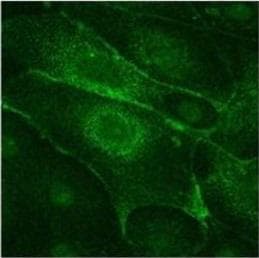 SLC6A3 / Dopamine Transporter Antibody (clone 6V-23-23)