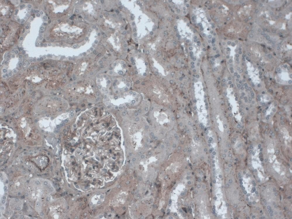 FN1 / Fibronectin Antibody (clone EP5)