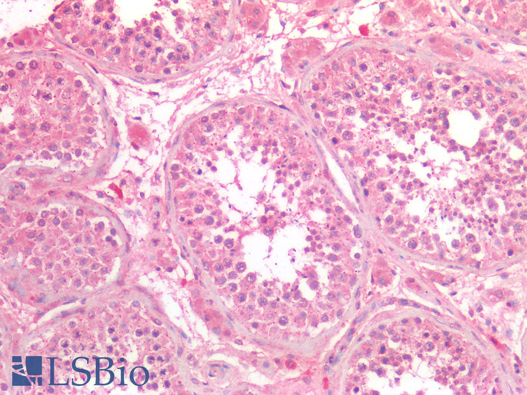 PathPlus™ Osteonectin / SPARC Antibody