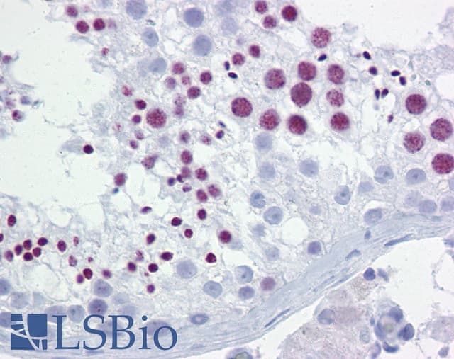 BRD3 Antibody (aa648-697) | LSBio