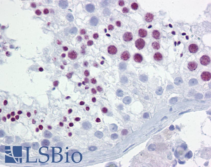 BRD3 Antibody (aa648-697) | LSBio