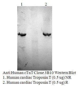 Monoclonal Mouse anti-Human TNNT2 / CTNT Antibody (clone 3B10-G11, WB)